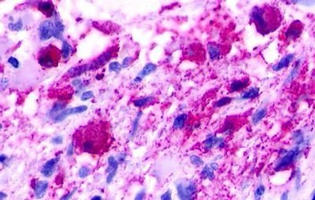 NMUR1 Antibody in Immunohistochemistry (Paraffin) (IHC (P))