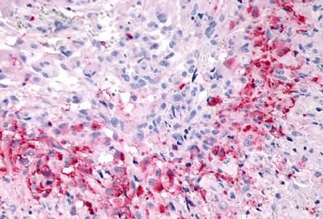 GPR133 Antibody in Immunohistochemistry (Paraffin) (IHC (P))