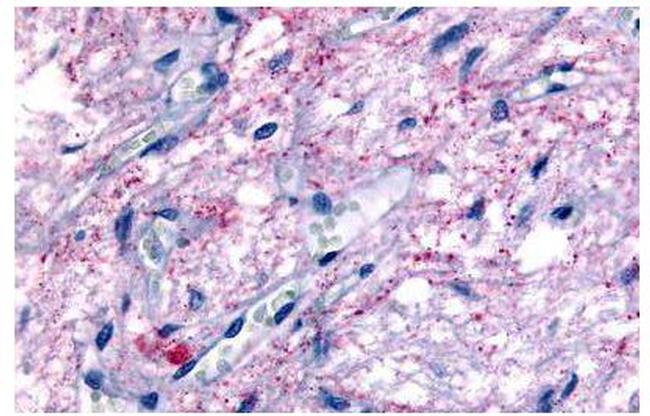 GPR50 Antibody in Immunohistochemistry (Paraffin) (IHC (P))