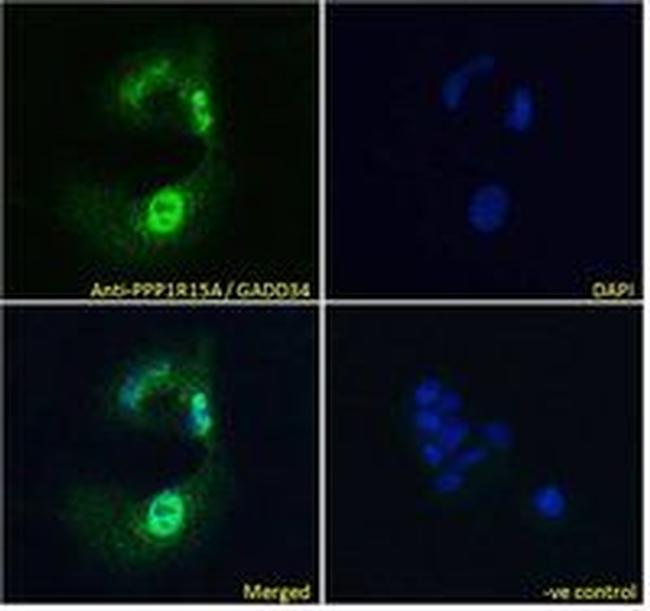 GADD34 Antibody in Immunocytochemistry (ICC/IF)