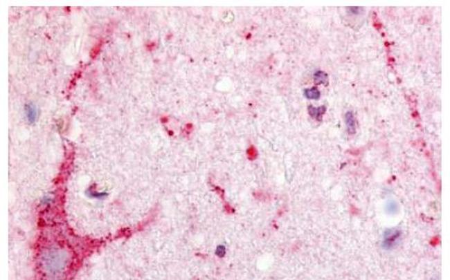 EDG8 Antibody in Immunohistochemistry (Paraffin) (IHC (P))