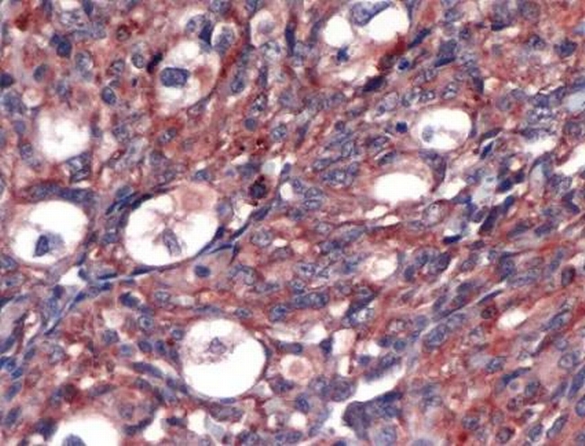 VEGF Antibody in Immunohistochemistry (Paraffin) (IHC (P))