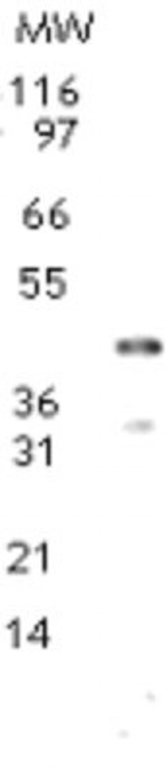 Dnmt2 Antibody in Western Blot (WB)