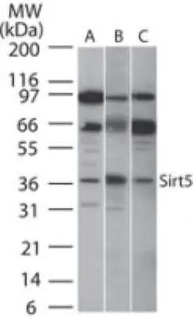 SIRT5 Antibody in Western Blot (WB)