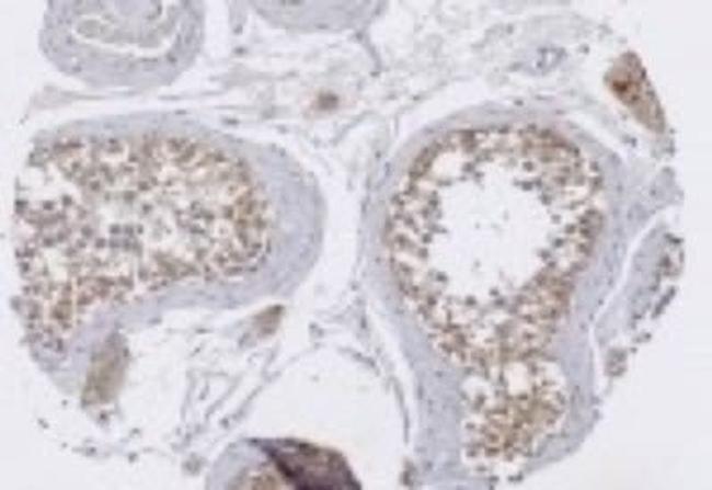 TRIM29 Antibody in Immunohistochemistry (Paraffin) (IHC (P))