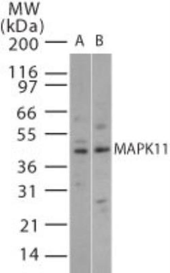 p38 MAPK beta Antibody in Western Blot (WB)