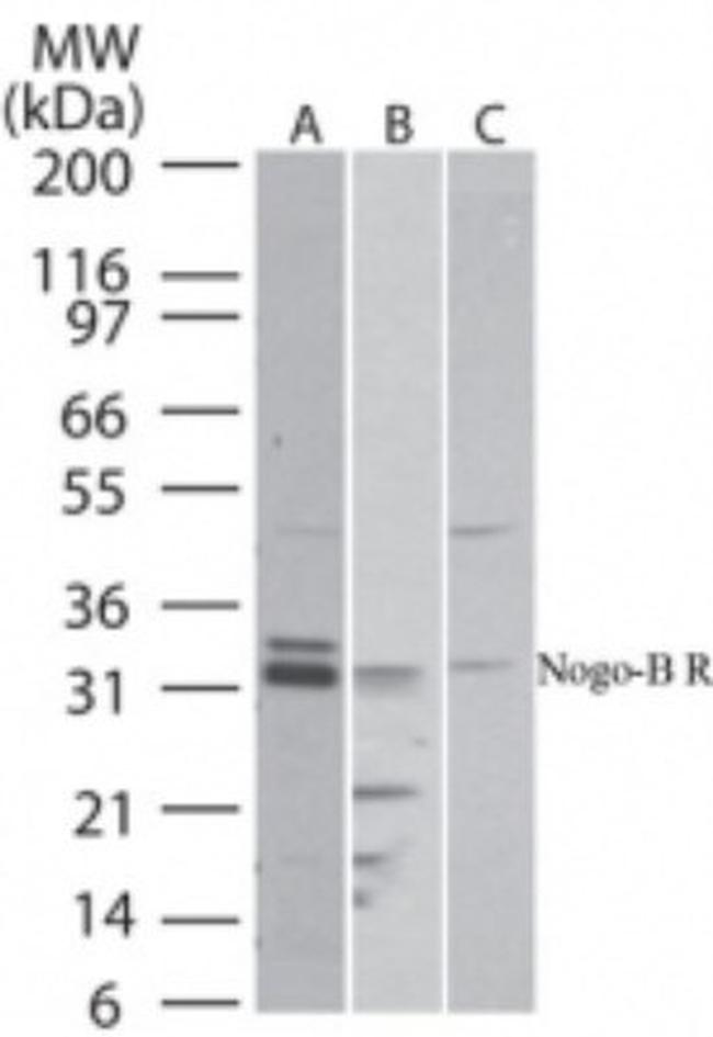 Nogo Receptor Antibody in Western Blot (WB)