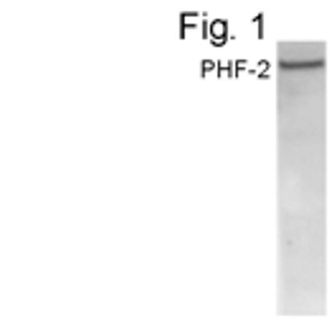 PHF2 Antibody in Western Blot (WB)