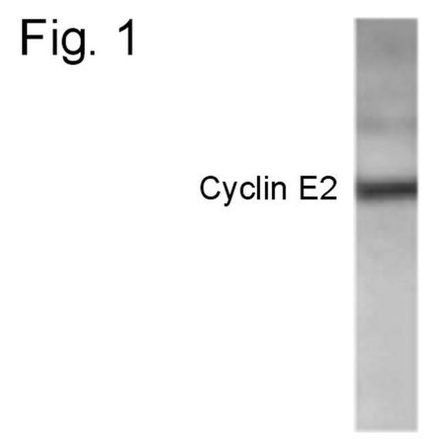 Cyclin E2 Antibody in Western Blot (WB)