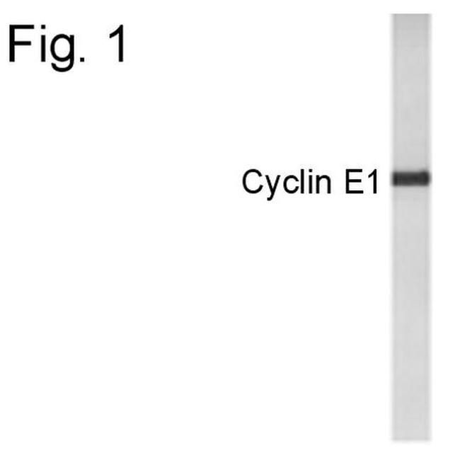 Cyclin E Antibody in Western Blot (WB)