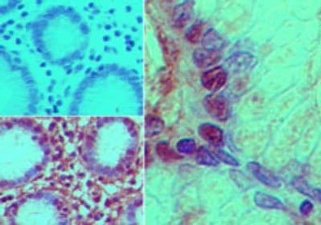 Nurim Antibody in Immunohistochemistry (Paraffin) (IHC (P))