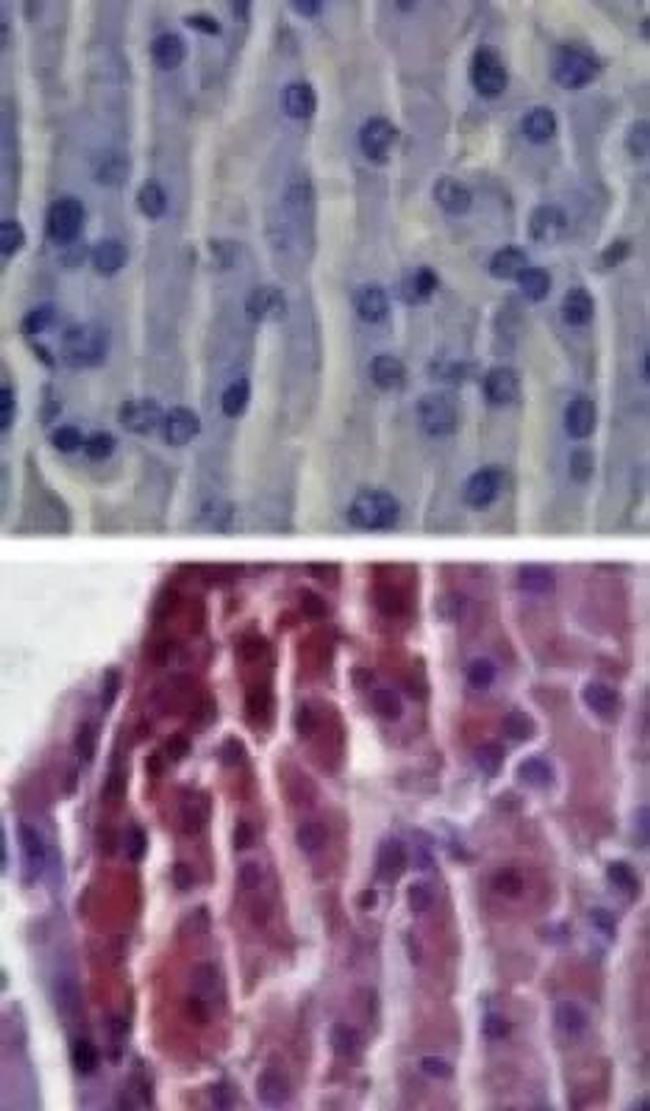 TLR2 Antibody in Immunohistochemistry (IHC)