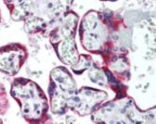 SSTR5 Antibody in Immunohistochemistry (Paraffin) (IHC (P))