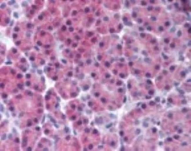 RIP3 Antibody in Immunohistochemistry (Paraffin) (IHC (P))