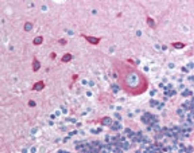 PACSIN2 Antibody in Immunohistochemistry (Paraffin) (IHC (P))