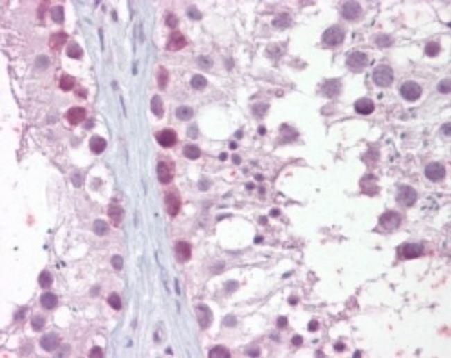 MRE11 Antibody in Immunohistochemistry (Paraffin) (IHC (P))