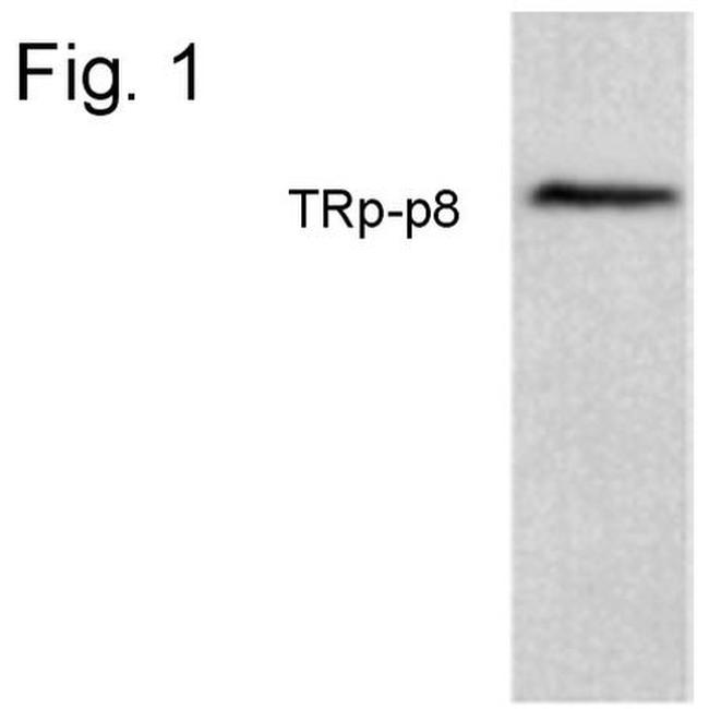 TRPM8 Antibody in Western Blot (WB)