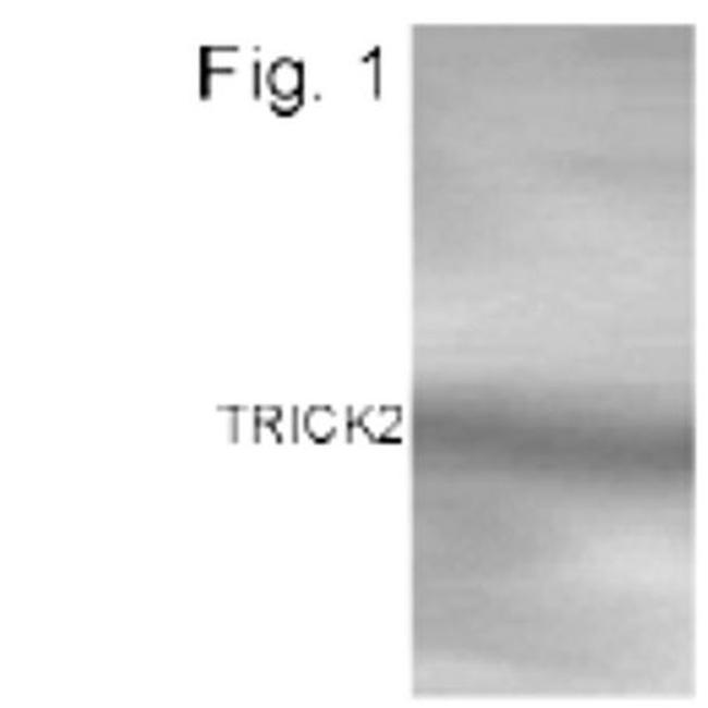 TRAIL-R2 (DR5) Antibody in Western Blot (WB)