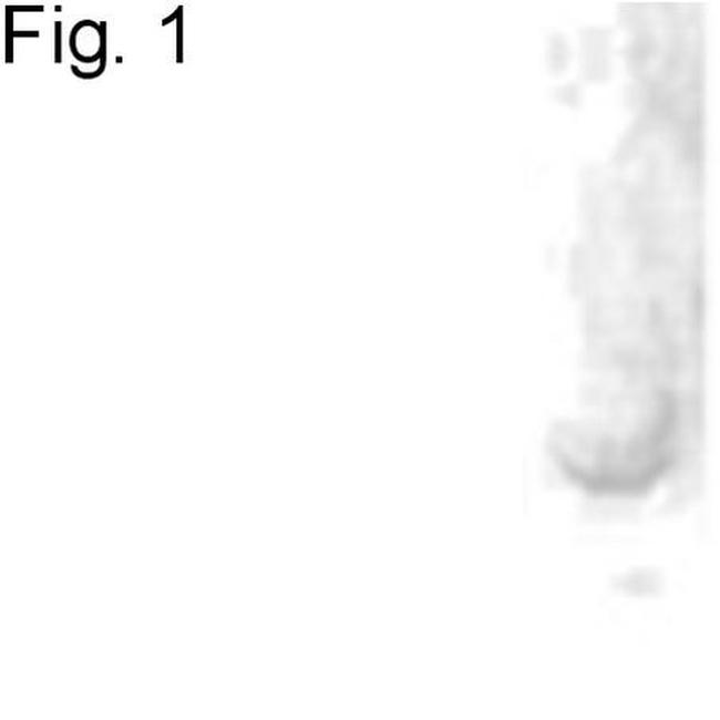 Noggin Antibody in Western Blot (WB)