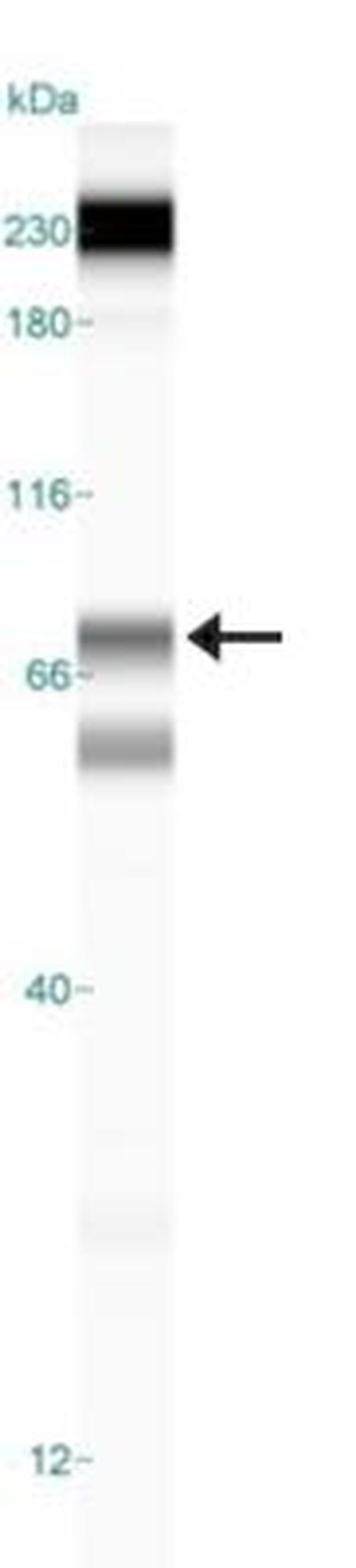 ALOX5 Antibody in Western Blot (WB)