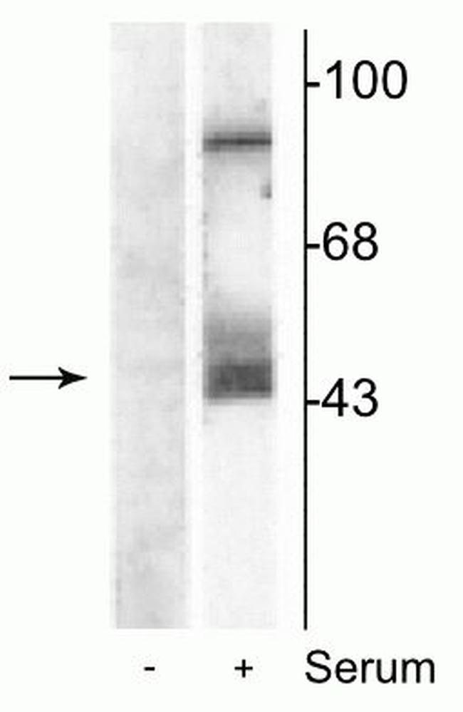 Phospho-MEK1/MEK2 (Ser217, Ser221) Antibody in Western Blot (WB)