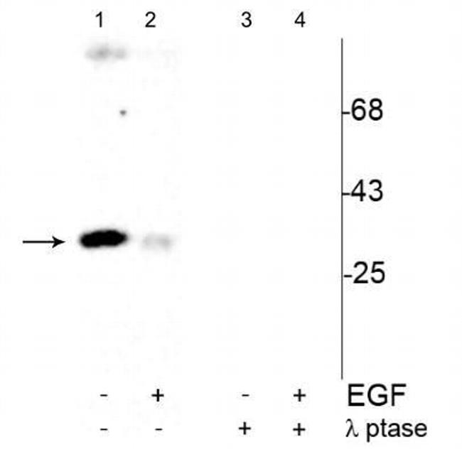 Phospho-CDK1 (Tyr15) Antibody in Western Blot (WB)