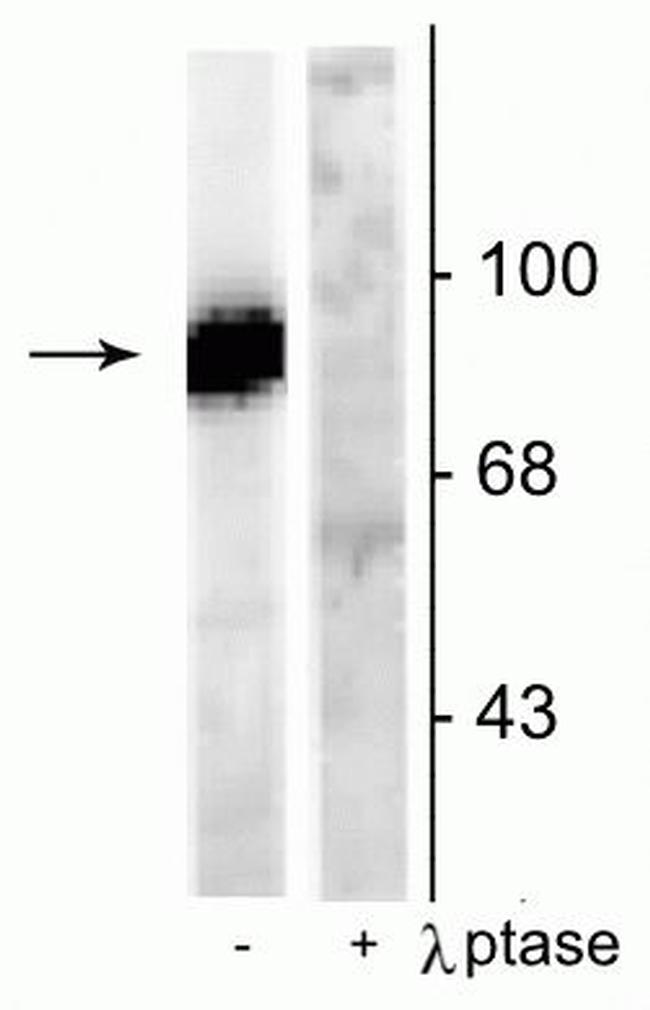 Phospho-Dynamin 1 (Ser778) Antibody in Western Blot (WB)