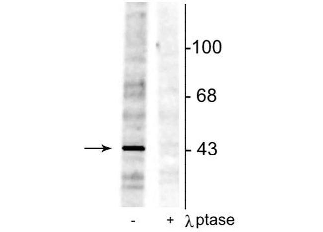 Phospho-EphB2 (Tyr298) Antibody in Western Blot (WB)