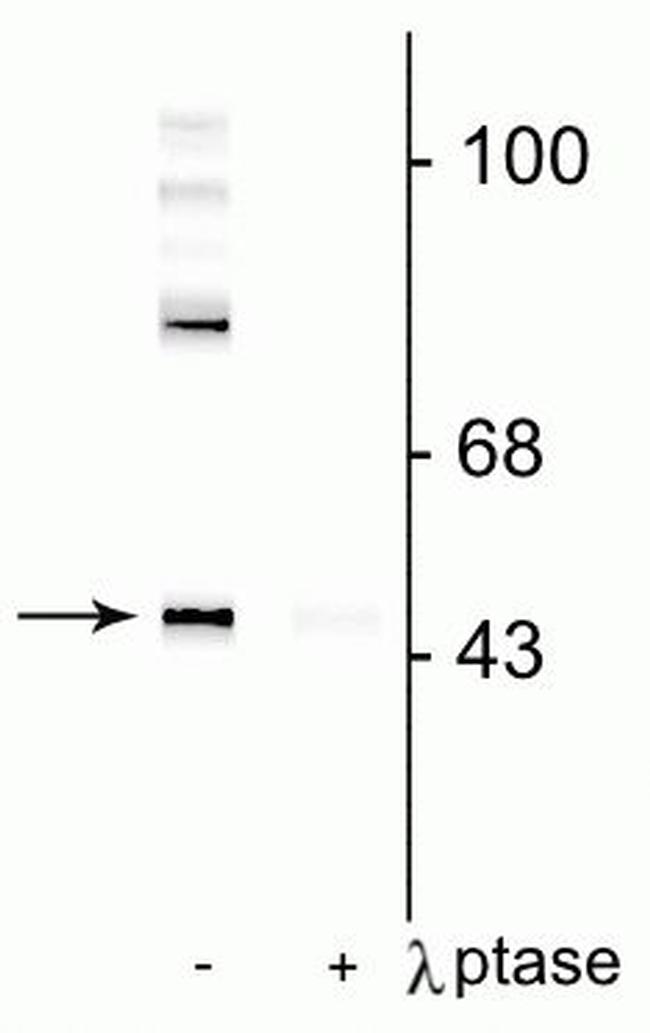 Phospho-GAP43 (Ser41) Antibody in Western Blot (WB)