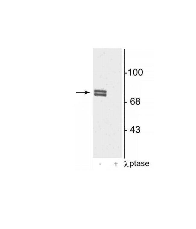 Phospho-ALOX5 (Ser523) Antibody in Western Blot (WB)