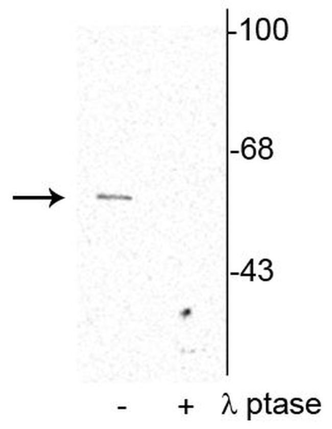 Phospho-Synaptotagmin 1 (Ser309) Antibody in Western Blot (WB)