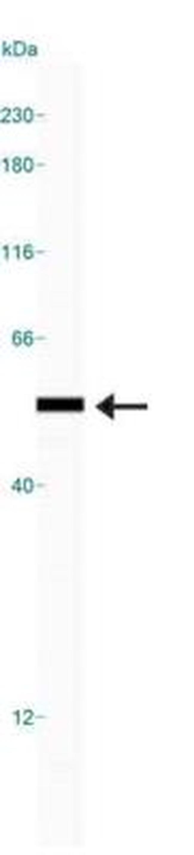 TRPML1 Antibody in Western Blot (WB)