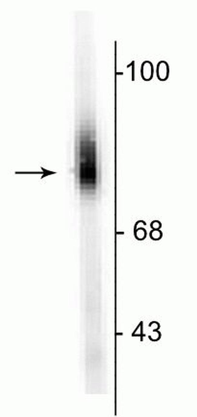 Dopamine beta Hydroxylase Antibody in Western Blot (WB)