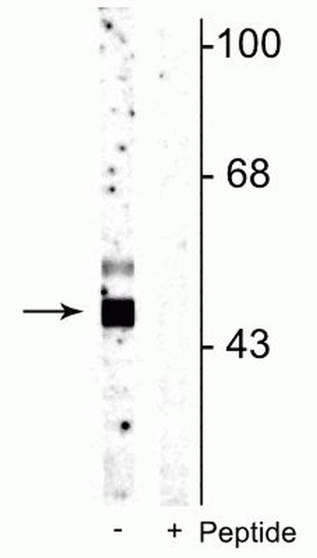 Phospho-GSK3B (Ser9) Antibody in Western Blot (WB)