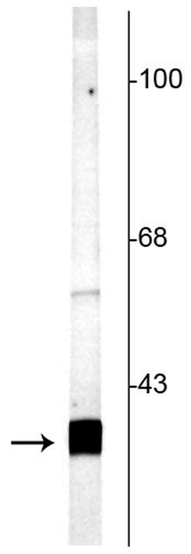 SNAP25 Antibody in Western Blot (WB)