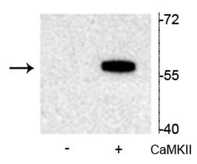 Phospho-TPH2 (Ser19) Antibody in Western Blot (WB)