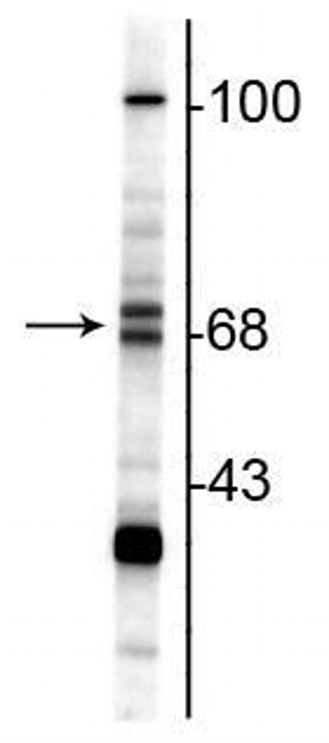 ChAT Antibody in Western Blot (WB)