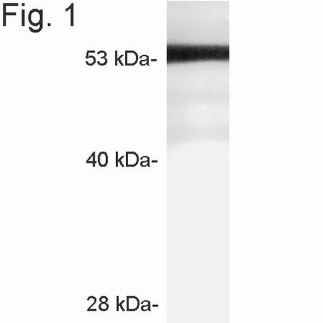 STARD3 Antibody in Western Blot (WB)