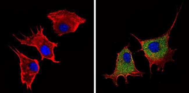 Angiostatin Antibody in Immunocytochemistry (ICC/IF)