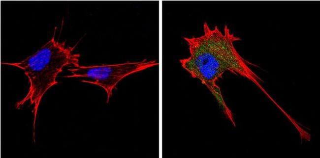 Endostatin Antibody in Immunocytochemistry (ICC/IF)