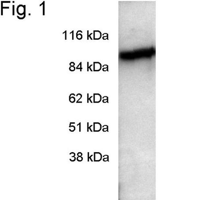 PDE6A Antibody in Western Blot (WB)