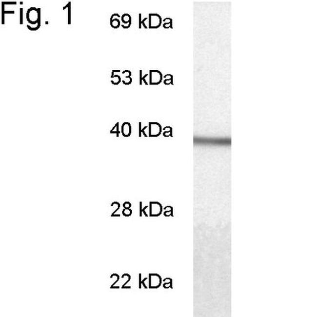 GNAT1 Antibody in Western Blot (WB)