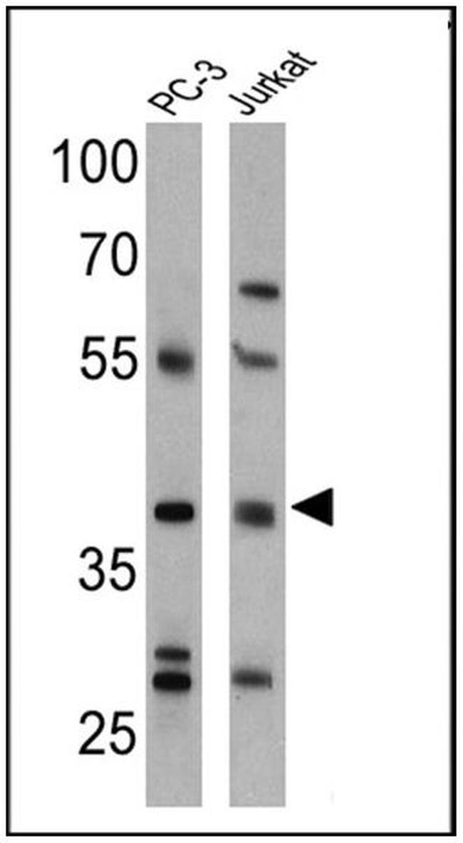 CNR2 Antibody in Western Blot (WB)