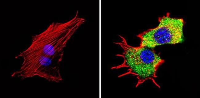 TPH1 Antibody in Immunocytochemistry (ICC/IF)