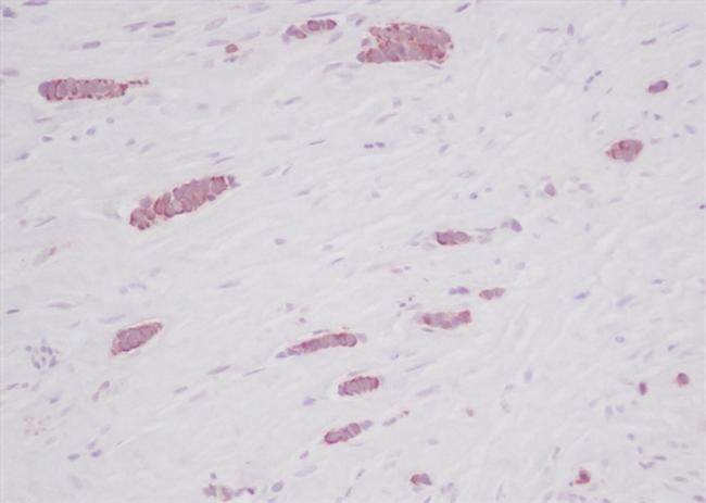 CCL5 (RANTES) Antibody in Immunohistochemistry (Paraffin) (IHC (P))