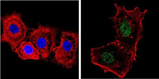 NCoR1 Antibody in Immunocytochemistry (ICC/IF)