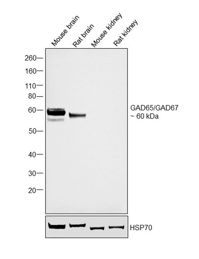 GAD65/GAD67 Antibody in Western Blot (WB)