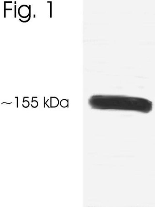 SRC3 Antibody in Western Blot (WB)