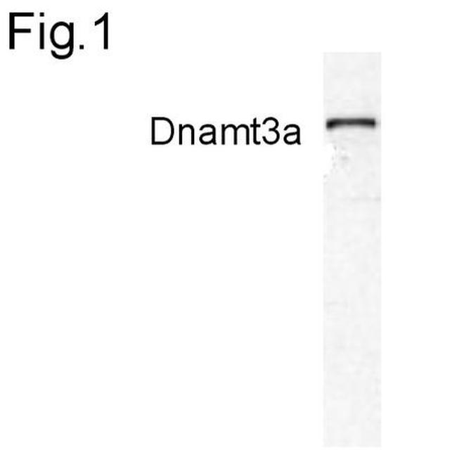 DNMT3A Antibody in Western Blot (WB)