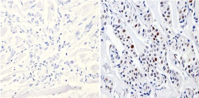 DNMT3B Antibody in Immunohistochemistry (Paraffin) (IHC (P))